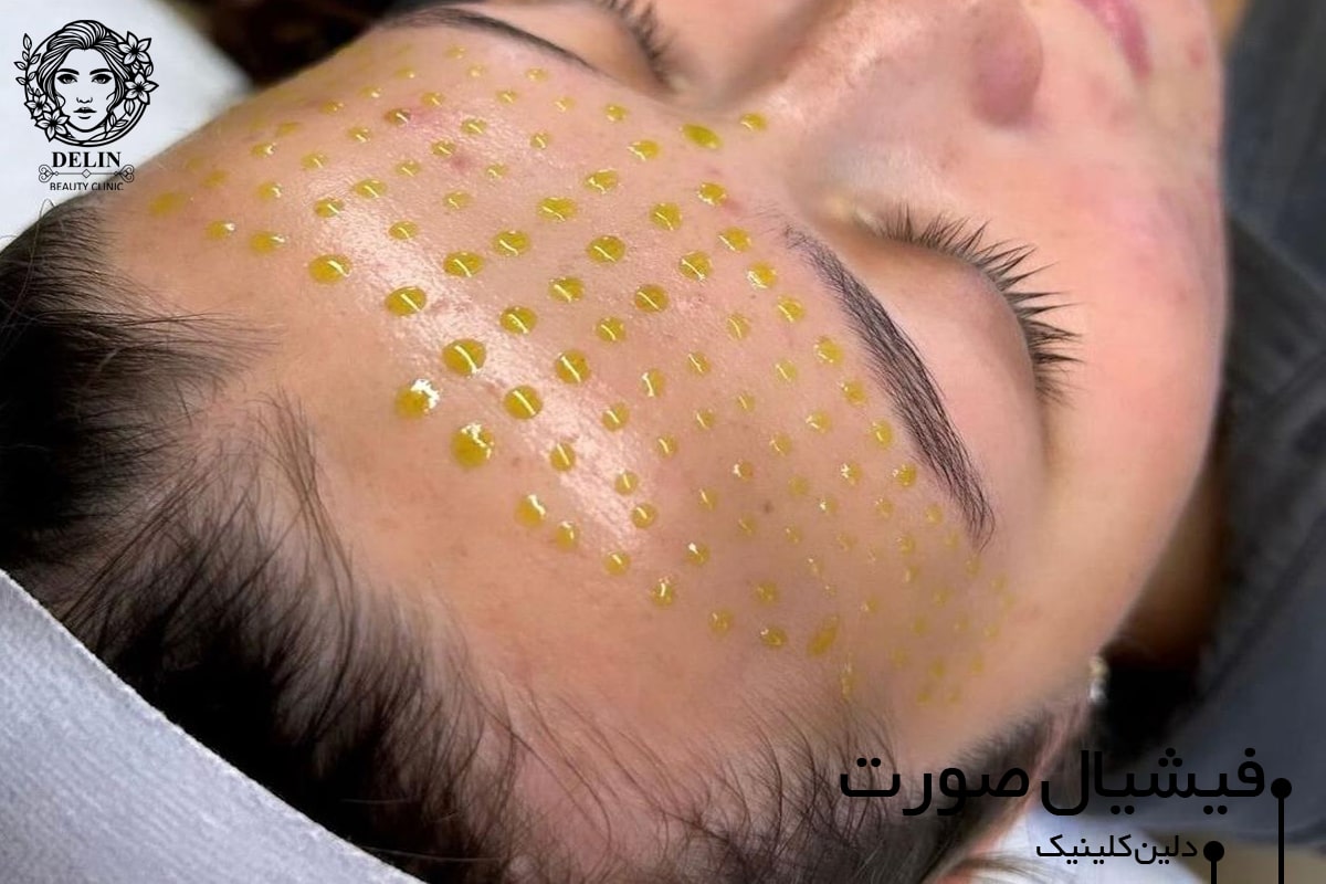 فیشیال پوست غرب تهران بلوار فردوس